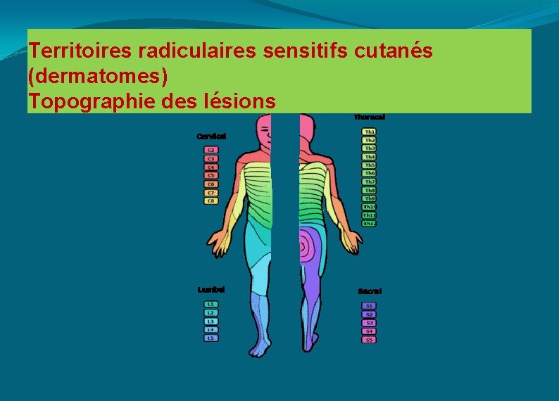 Territoires radiculaires sensitifs cutanés (dermatomes) Topographie des lésions 