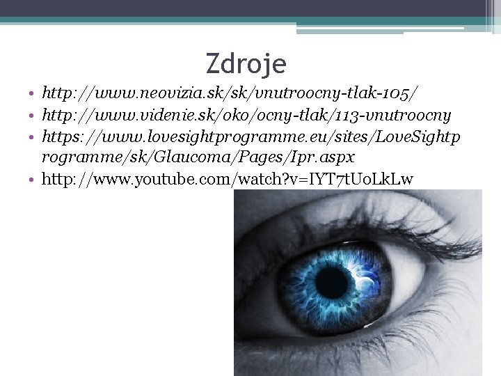 Zdroje • http: //www. neovizia. sk/sk/vnutroocny-tlak-105/ • http: //www. videnie. sk/oko/ocny-tlak/113 -vnutroocny • https: