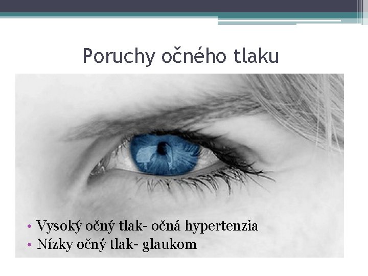 Poruchy očného tlaku • Vysoký očný tlak- očná hypertenzia • Nízky očný tlak- glaukom