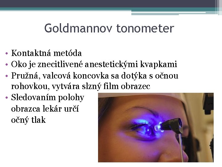 Goldmannov tonometer • Kontaktná metóda • Oko je znecitlivené anestetickými kvapkami • Pružná, valcová