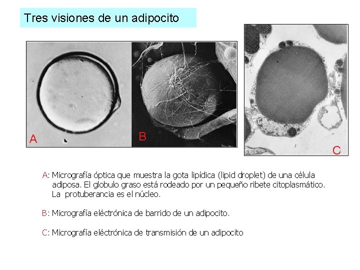 Tres visiones de un adipocito A B C A: Micrografía óptica que muestra la