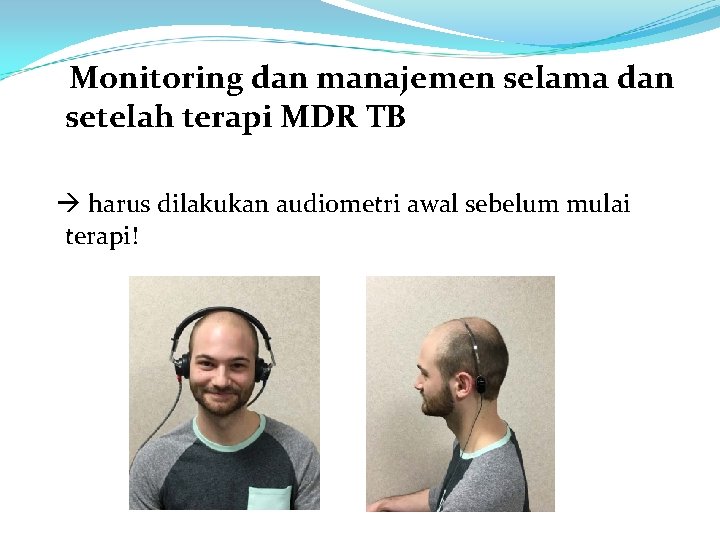 Monitoring dan manajemen selama dan setelah terapi MDR TB harus dilakukan audiometri awal sebelum