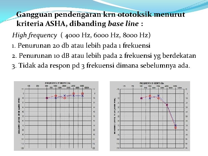  Gangguan pendengaran krn ototoksik menurut kriteria ASHA, dibanding base line : High frequency