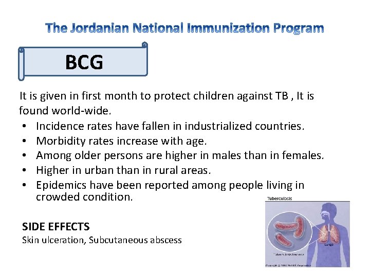 BCG It is given in first month to protect children against TB , It
