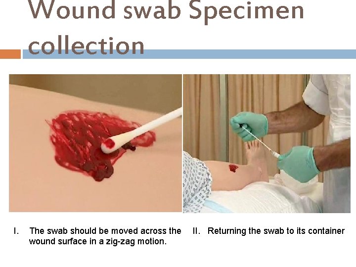 Wound swab Specimen collection I. The swab should be moved across the II. Returning