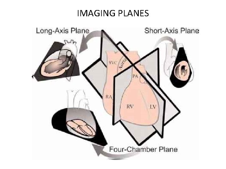 IMAGING PLANES 