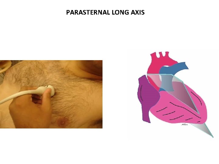 PARASTERNAL LONG AXIS 