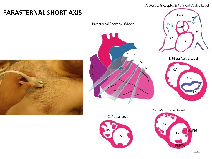 PARASTERNAL SHORT AXIS 
