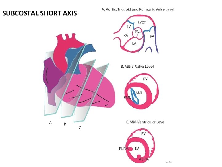 SUBCOSTAL SHORT AXIS 