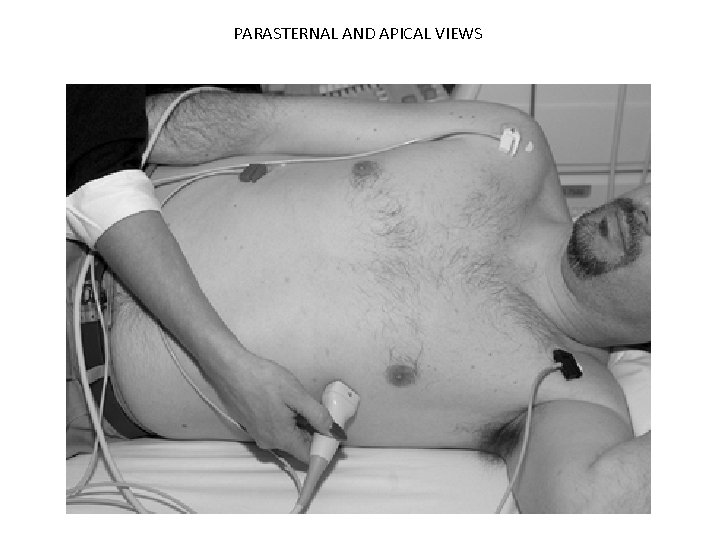 PARASTERNAL AND APICAL VIEWS 