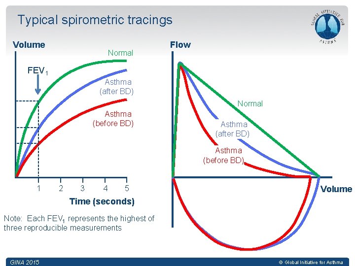 Typical spirometric tracings Volume Normal Flow FEV 1 Asthma (after BD) Normal Asthma (before