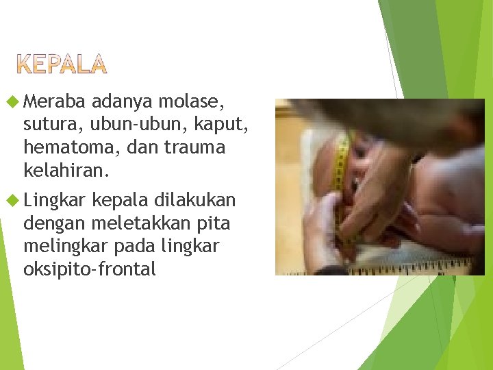  Meraba adanya molase, sutura, ubun-ubun, kaput, hematoma, dan trauma kelahiran. Lingkar kepala dilakukan