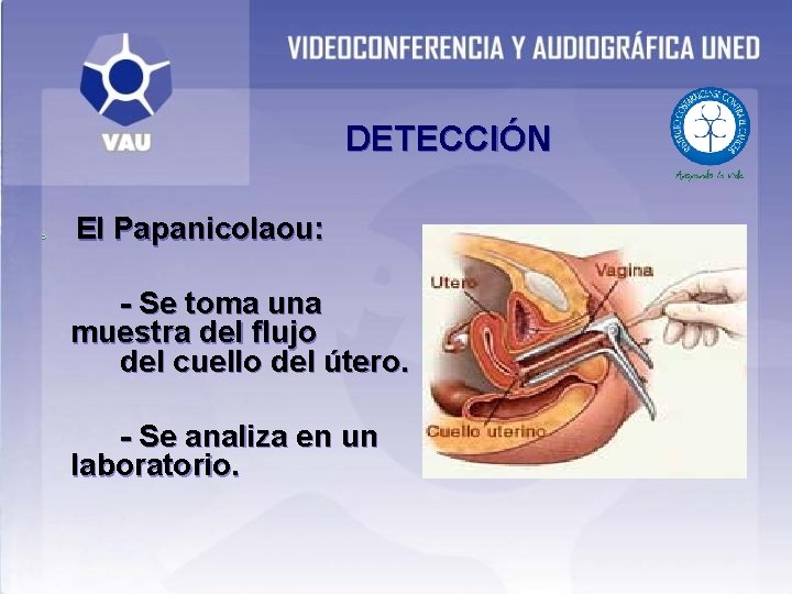 DETECCIÓN Ü El Papanicolaou: - Se toma una muestra del flujo del cuello del