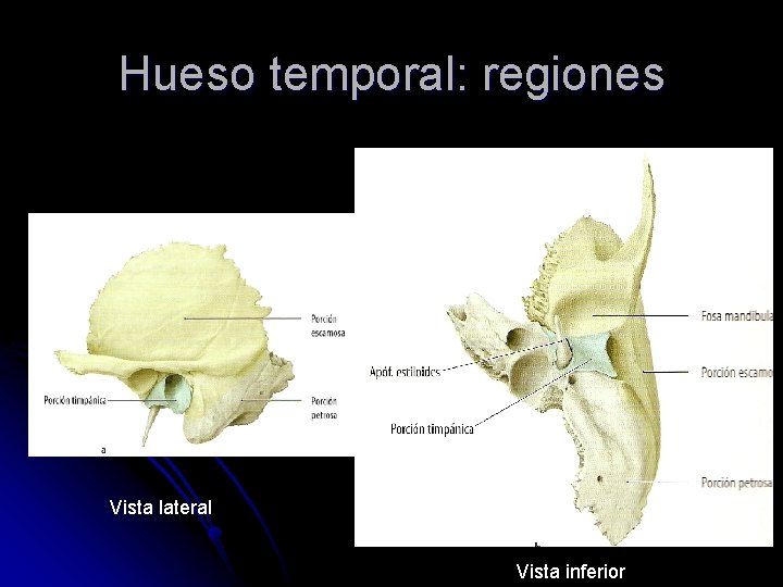 Hueso temporal: regiones Vista lateral Vista inferior 