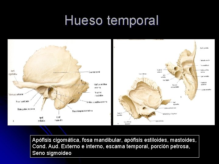 Hueso temporal Apófisis cigomática, fosa mandibular, apófisis estiloides, mastoides, Cond. Aud. Externo e interno,