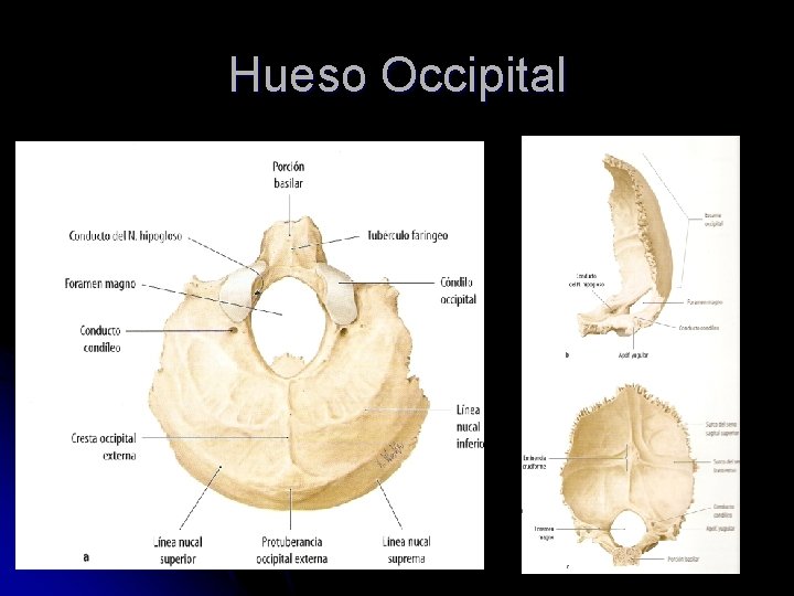 Hueso Occipital 