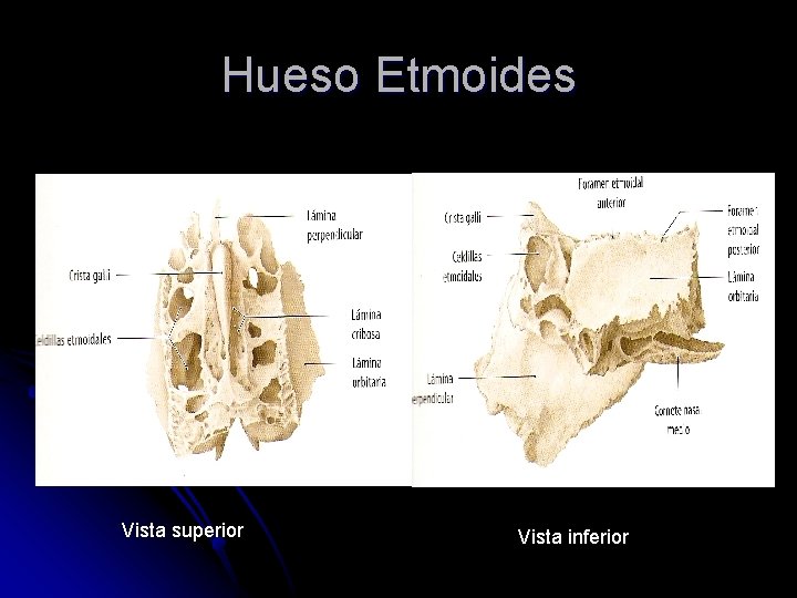 Hueso Etmoides Vista superior Vista inferior 