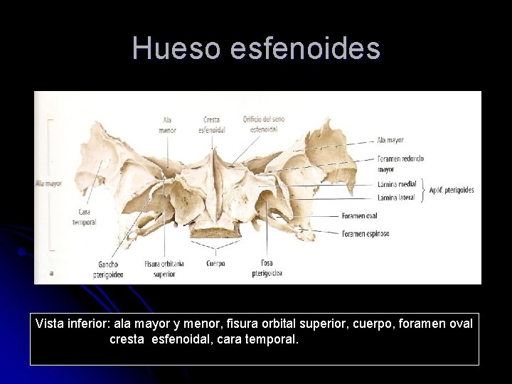 Hueso esfenoides Vista inferior: ala mayor y menor, fisura orbital superior, cuerpo, foramen oval