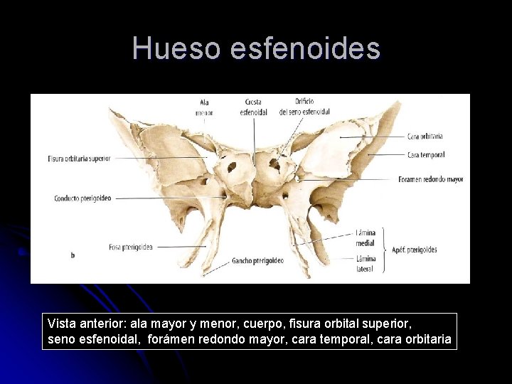 Hueso esfenoides Vista anterior: ala mayor y menor, cuerpo, fisura orbital superior, seno esfenoidal,