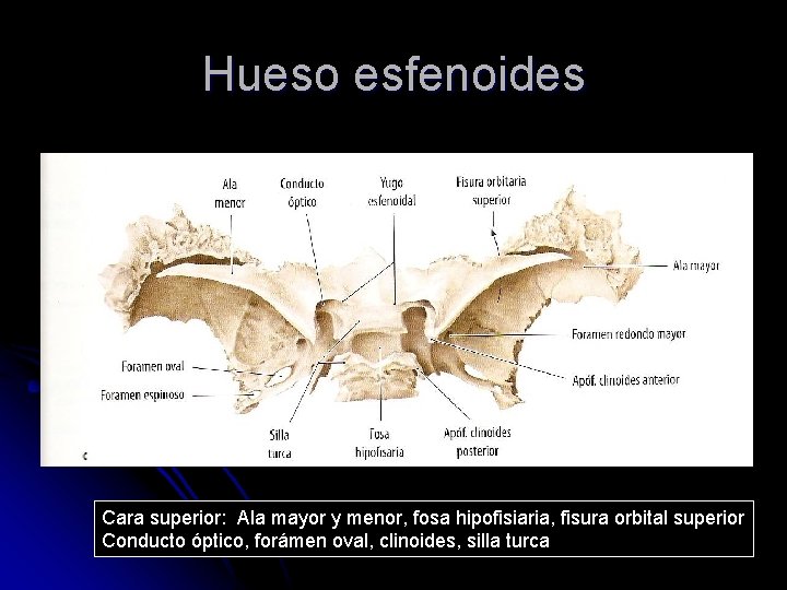 Hueso esfenoides Cara superior: Ala mayor y menor, fosa hipofisiaria, fisura orbital superior Conducto