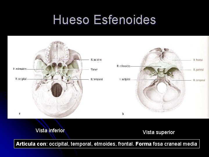 Hueso Esfenoides Vista inferior Vista superior Articula con: occipital, temporal, etmoides, frontal. Forma fosa