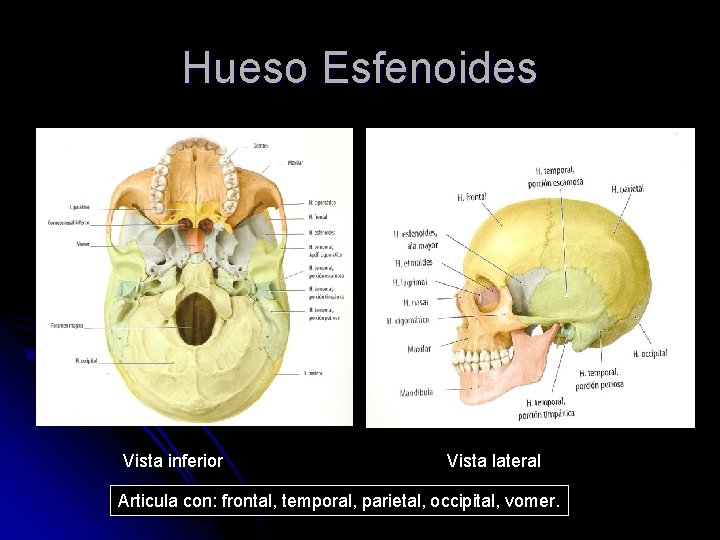 Hueso Esfenoides Vista inferior Vista lateral Articula con: frontal, temporal, parietal, occipital, vomer. 