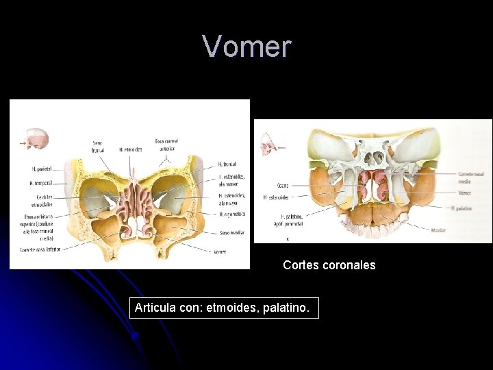 Vomer Cortes coronales Articula con: etmoides, palatino. 