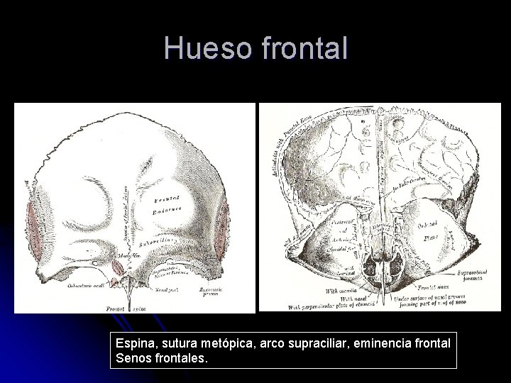 Hueso frontal Espina, sutura metópica, arco supraciliar, eminencia frontal Senos frontales. 