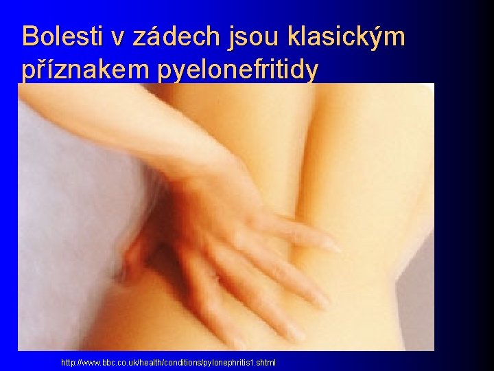 Bolesti v zádech jsou klasickým příznakem pyelonefritidy http: //www. bbc. co. uk/health/conditions/pylonephritis 1. shtml