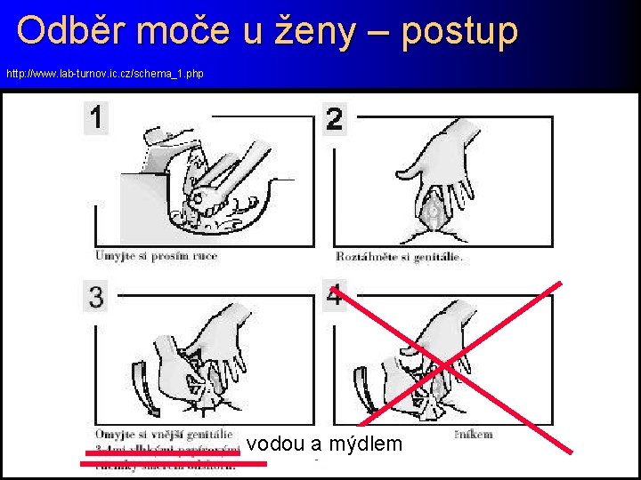 Odběr moče u ženy – postup http: //www. lab-turnov. ic. cz/schema_1. php vodou a