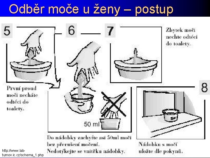 Odběr moče u ženy – postup http: //www. labturnov. ic. cz/schema_1. php 