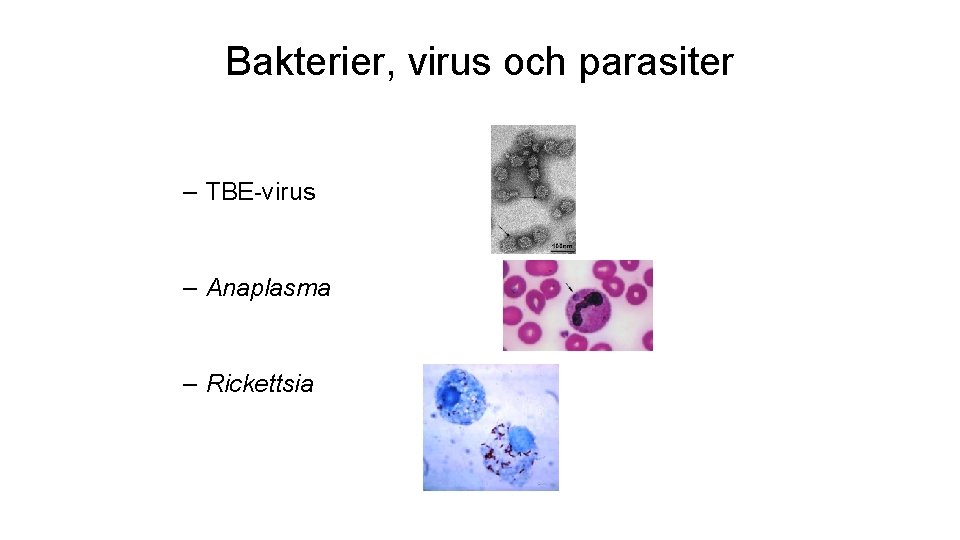 Bakterier, virus och parasiter – TBE-virus – Anaplasma – Rickettsia 