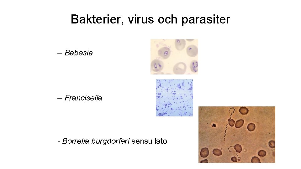 Bakterier, virus och parasiter – Babesia – Francisella - Borrelia burgdorferi sensu lato 