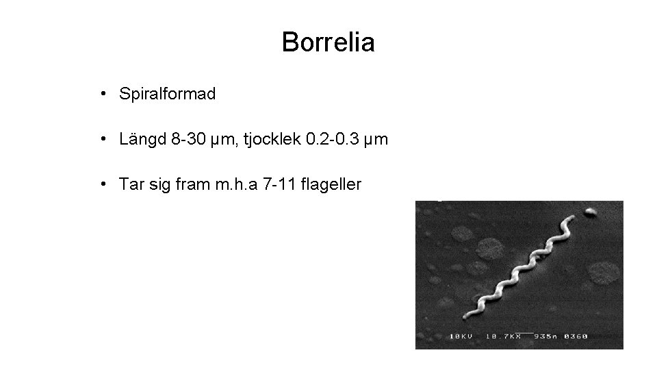 Borrelia • Spiralformad • Längd 8 -30 µm, tjocklek 0. 2 -0. 3 µm