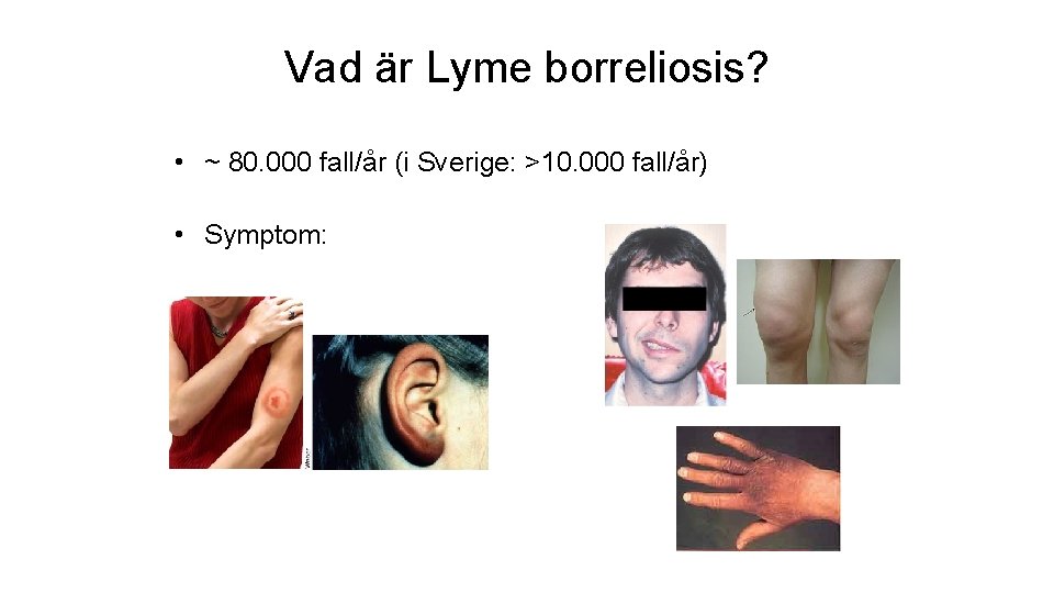 Vad är Lyme borreliosis? • ~ 80. 000 fall/år (i Sverige: >10. 000 fall/år)