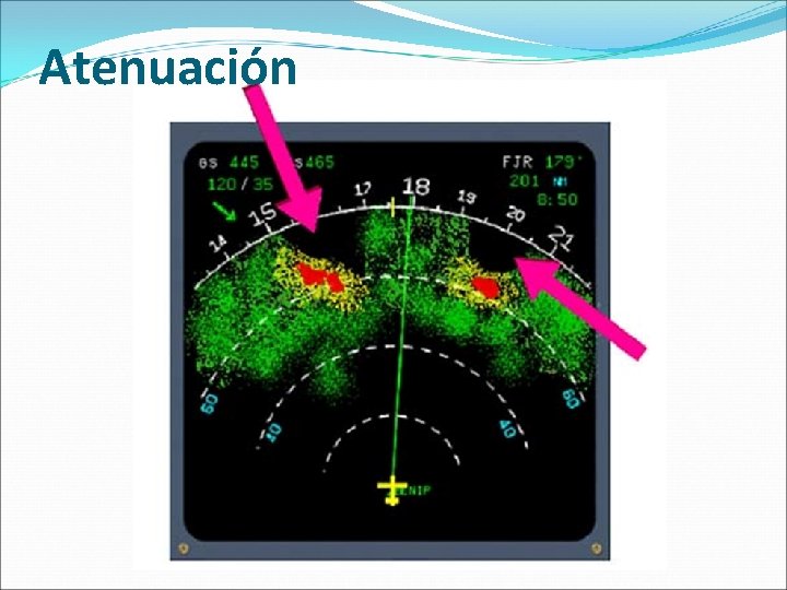 Atenuación 