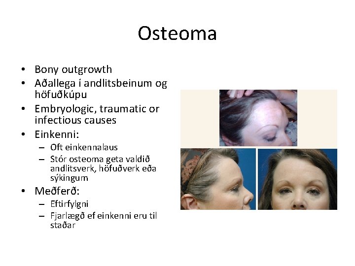 Osteoma • Bony outgrowth • Aðallega í andlitsbeinum og höfuðkúpu • Embryologic, traumatic or