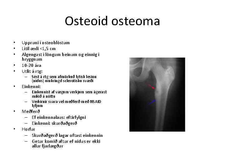 Osteoid osteoma • • • Uppruni í osteoblöstum Lítil æxli <1, 5 cm Algengust