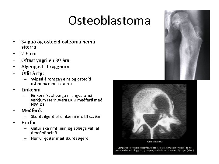 Osteoblastoma • • • Svipað og osteoid osteoma nema stærra 2 -6 cm Oftast