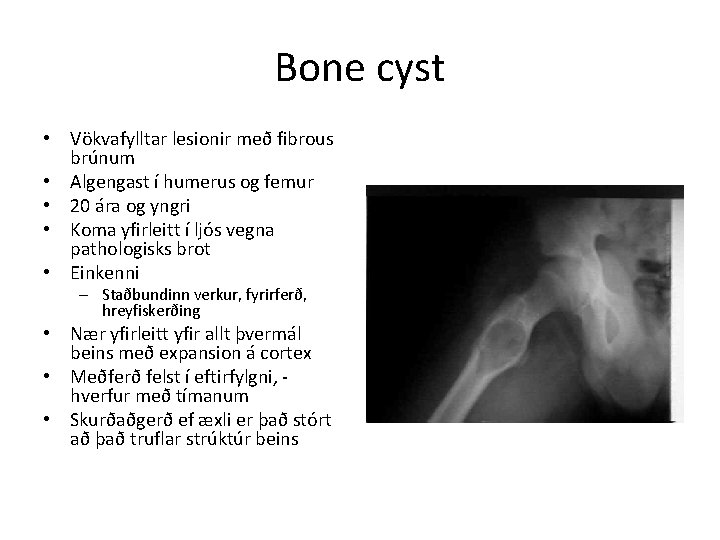 Bone cyst • Vökvafylltar lesionir með fibrous brúnum • Algengast í humerus og femur
