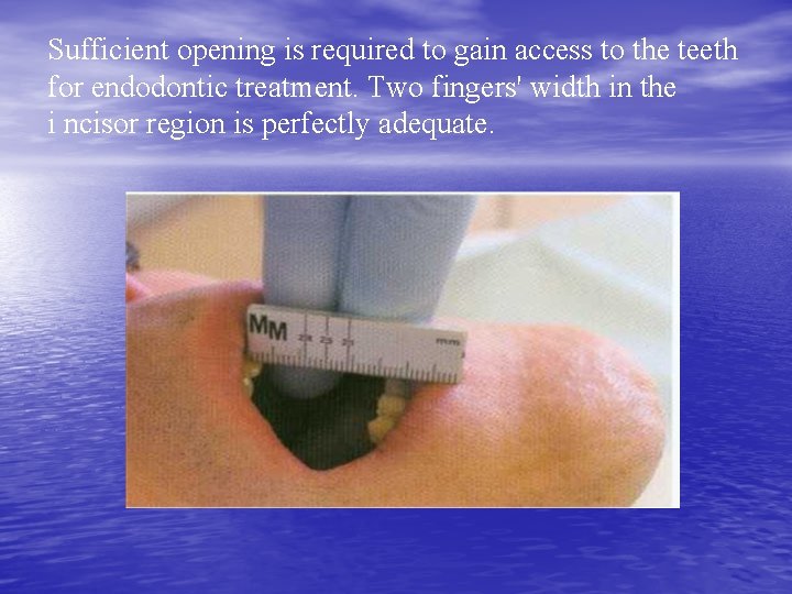 Sufficient opening is required to gain access to the teeth for endodontic treatment. Two