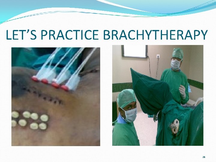 LET’S PRACTICE BRACHYTHERAPY 21 