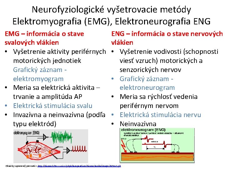 Neurofyziologické vyšetrovacie metódy Elektromyografia (EMG), Elektroneurografia ENG EMG – informácia o stave svalových vlákien