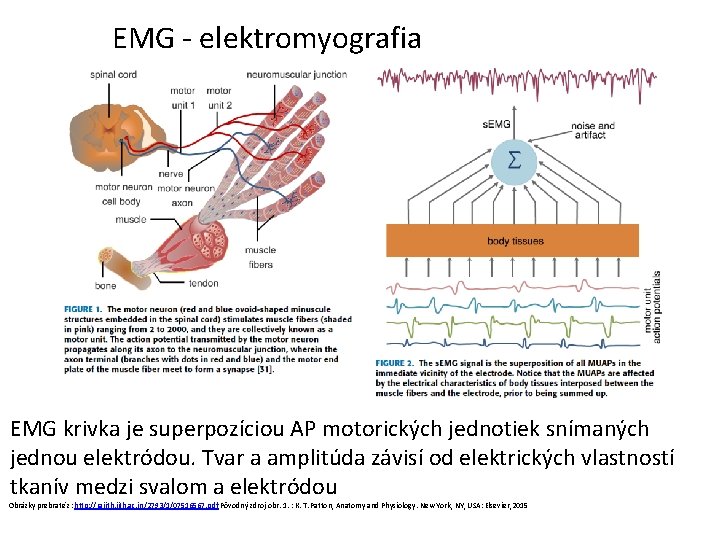 EMG - elektromyografia EMG krivka je superpozíciou AP motorických jednotiek snímaných jednou elektródou. Tvar