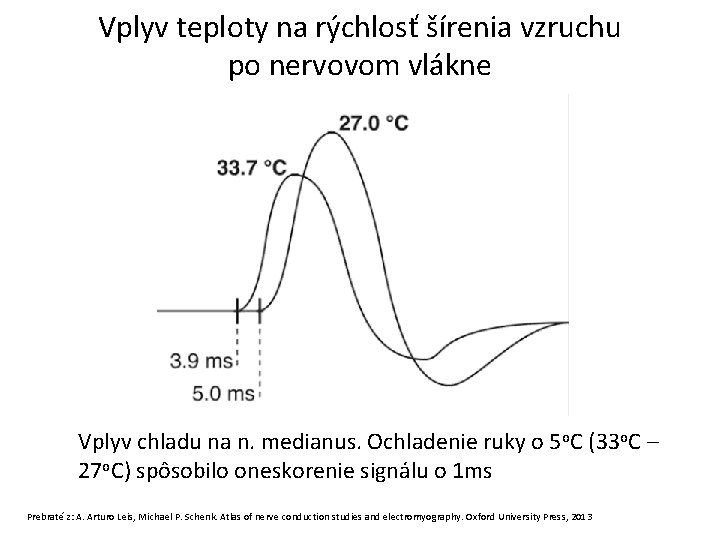 Vplyv teploty na rýchlosť šírenia vzruchu po nervovom vlákne Vplyv chladu na n. medianus.