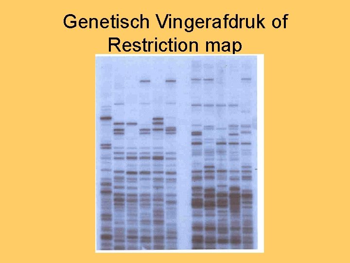 Genetisch Vingerafdruk of Restriction map 