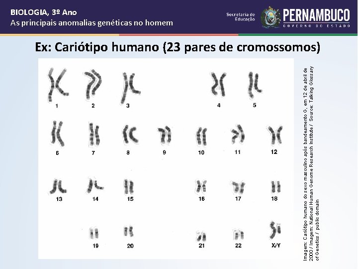 Imagem: Cariótipo humano do sexo masculino após bandeamento G, em 12 de abril de