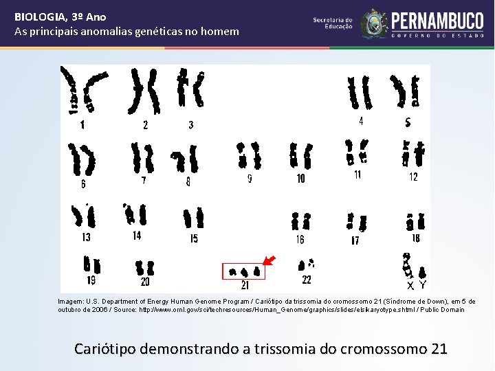 BIOLOGIA, 3º Ano As principais anomalias genéticas no homem Imagem: U. S. Department of