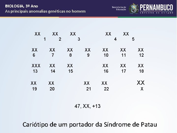 BIOLOGIA, 3º Ano As principais anomalias genéticas no homem XX XX 1 XX 2