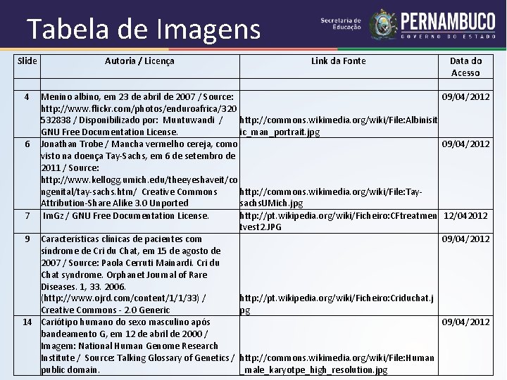 Tabela de Imagens Slide 4 Autoria / Licença Link da Fonte Menino albino, em